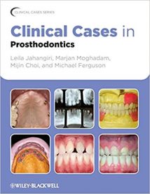 Clinical Cases In Prosthodontics, 2014