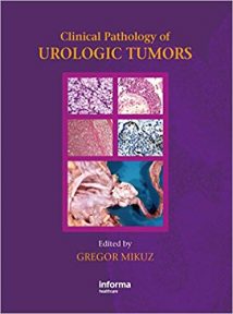 Clinical Pathology Of Urological Tumors, 2007