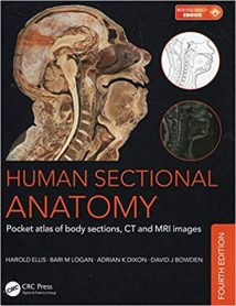 Human Sectional Anatomy - Atlas Of Body Sections, Ct And Mri Images, 2015