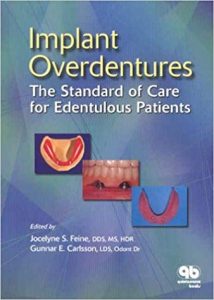 Implant Overdentures The Standard Of Care For Edentulous Patients, 2003.epub