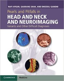 Pearls And Pitfalls In Head And Neck And Neuroimaging - Variants And Other Difficult Diagnoses, 2013