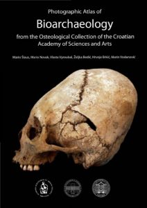 Photographic Atlas Of Human Bioarchaeology From The Osteological Collections Of The Croatian Academy Of Sciences And Arts, 2013