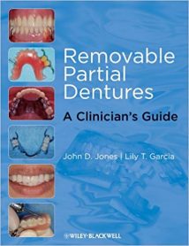 Removable Partial Dentures A Clinician'S Guide (Restorative Dentistry), 2009