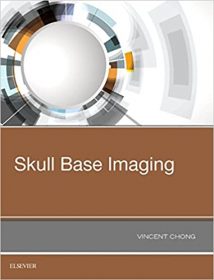 Skull Base Imaging, 2017