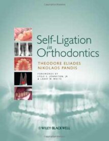 Self-Ligation In Orthodontics, 2009